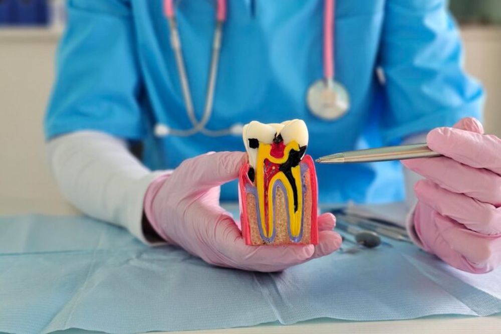 Recovery After Root Canal Treatment: What To Expect