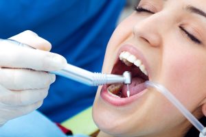 receding gums here's how gum grafting can save your smile